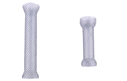 1514252011148889.bmp 食道.bmp